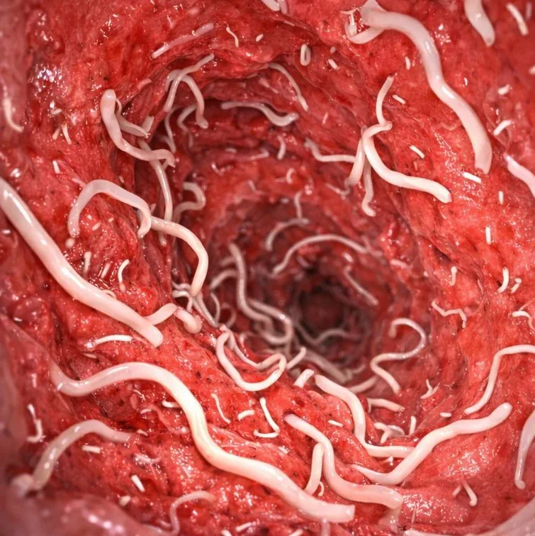 Before intestine