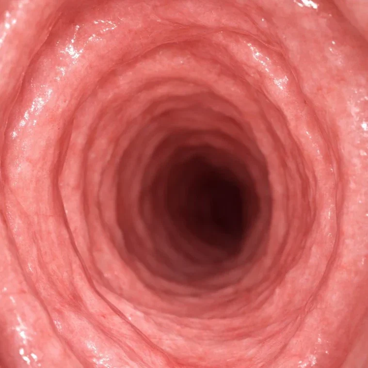After intestine